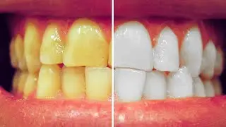 Whitening Teeth in Photoshop | Photoshop Tutorial | PiXEL PLANET