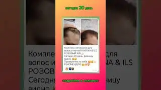 сегодня 20 день #сибирскоездоровьекупить #витамины_для_роста_волос #ногтиукрепились #розовыйкуб