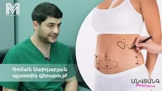 ԱԲԴՈՄԻՆՈՊԼԱՍՏԻԿԱ կամ ՈՐՈՎԱՅՆԻ ՁԳՈւՄ. ծննդաբերությունից հետո թուլացած մաշկն այլևս խնդիր չէ #medmedia