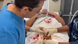 Testicular Tissue Removal for Labs
