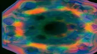 The Odd Blob