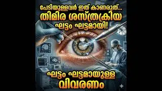പേടി ഉള്ളവർ ദയവായി ഈ വീഡിയോ കാണരുത്… തിമിര ശസ്ത്രക്രിയയെക്കുറിച്ചുള്ള വിശദമായ വിവരങ്ങൾ!