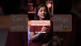 Lose 10kg Without Exercise | How much Weight Can You Lose With Liposuction? | SB Aesthetics