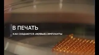 Как создаются «живые» импланты