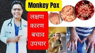 Monkey Pox