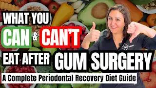 What to Eat After Gum Surgery (Dental Implants, Gum Graft, Extraction & More) + What Foods to Avoid