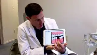 What Happens When You Lose A Tooth?