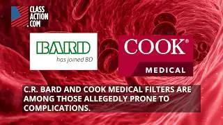 Is Your IVC Filter Putting You at Risk of Severe Injury?