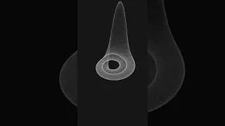 The Rössler attractor