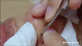 針清記錄2 香港美容店 SaMuu Beauty