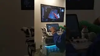 Eco Abdominal con el Hera Elite. Aquí ampliamos el concepto del Ángulo de Incidencia en Doppler.