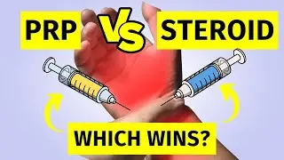 Carpal Tunnel Syndrome PRP vs Steroid Injection