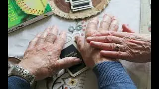 The Knobbles   Hands of Sligo