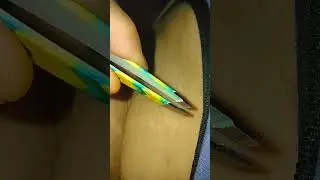 UNDERARM HAIR EXTRACTIONS (2022) • ARMPIT HAIR Removal Using Tweezers • Most Oddly SATISFYING Video