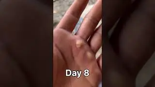 Day 8. 75 hard challenge #arunachalpradesh #75hard