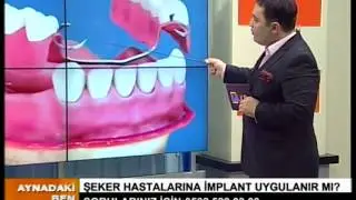 İlker Erdoğan_Diş eksikliklerinin giderilmesi