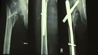 British Trauma Course 6