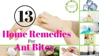 Top 13 Home Remedies For Ant Bites | BEAUTY TIPS
