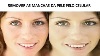 Remover as manchas da pele pelo celular