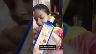 #stretchmarksremoval