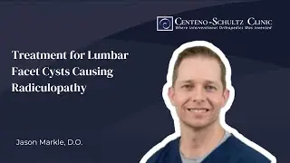 Treatment for Lumbar Facet Cysts Causing Radiculopathy | w/ Dr. Jason Markle