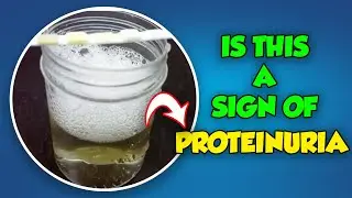 Is Foamy Urine Always a Sign of Proteinuria