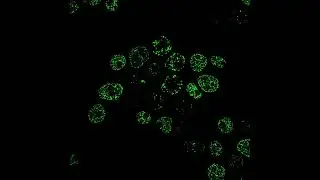 DNA damage response under SIM5 (slow) 