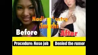 Top 15 Mga artistang proud na Retokada at artistang hindi umaming retoke | Alamin