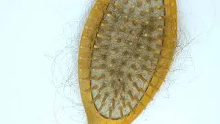 hairbrush with fallen out hair lots of fallen hai 2022 08 05 03 25 19 utc