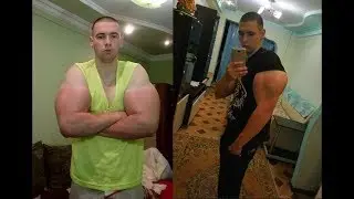 КИРИЛЛ ТЕРЕШИН, ОТВЕТ ВРАЧЕЙ !!ЧТО ДАЛЬШЕ ???