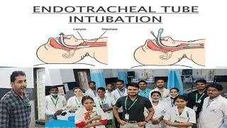 Endotracheal tube Intubation | #mbbs #nursing #paramedical #pathology #hospital #nabhhospital
