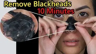 10 Minutes Do THIS to Remove Blackheads from Your Nose at Home