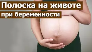 Dark line on belly during pregnancy