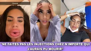 MARWA DÉFIGURÉE APRÈS UNE INJECTION, ELLE EXPLIQUE CE QUI S'EST PASSÉE