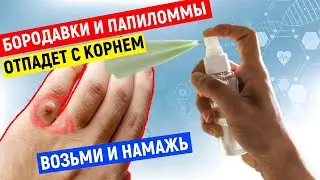 Дерматолог: Отпадают с корнем бородавки и папилломы, если пользоваться этим ....