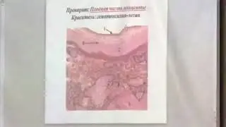 Плодная часть плаценты. Гистология