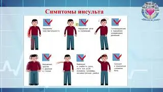 Занятие в "Школе по уходу". "Инсульт"
