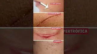 Tenes algo de esto? #skincare