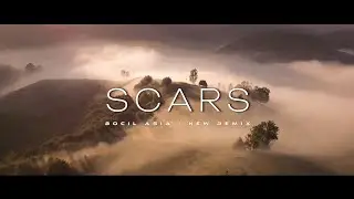 JEDAG JEDUG !!! Bocil Asia - Scars - ( New Remix )