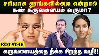 கண் கருவளையத்தை நீக்க சிறந்த வழி! | சரியாக தூங்கவில்லை என்றால் கண் கருவளையம் வருமா? |  | EOT 057