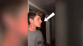 HOW TO GET A JAWLINE INSTANTLY 😳 - 