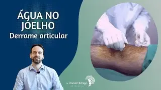 Água no joelho - Saiba o que pode ocasionar o derrame articular do joelho.