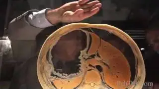 The Real Human Bodies Exhibit