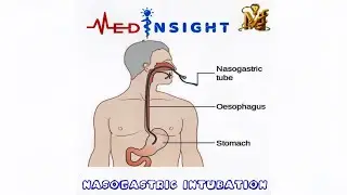 NASOGASTRIC (NG) TUBE INSERTION🩺| VIVA AND POST ENCOUNTER QUESTIONS|LECTURE VIDEO PART 1 |OSCE GUIDE