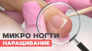 Наращивание на мини ногти трамплины | Онихолизис
