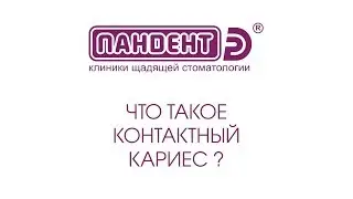 Что такое контактный кариес?