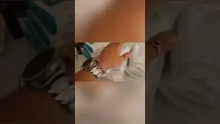 абдоминопластика ! перевязочные материалы! первые дни!