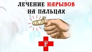 Лечение нарывов на пальцах