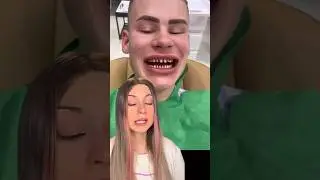 Надо ли сильно обтачивать зубы под виниры? #стоматология #виниры