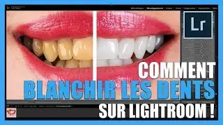 Comment blanchir les dents sur Lightroom [TUTO-PHOTOS]